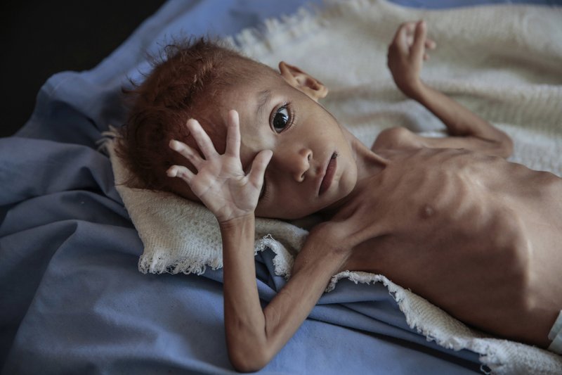Yemen